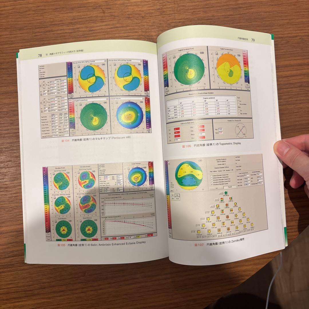 【美品・絶版】眼科　身につく角膜トポグラフィーの検査と読み方