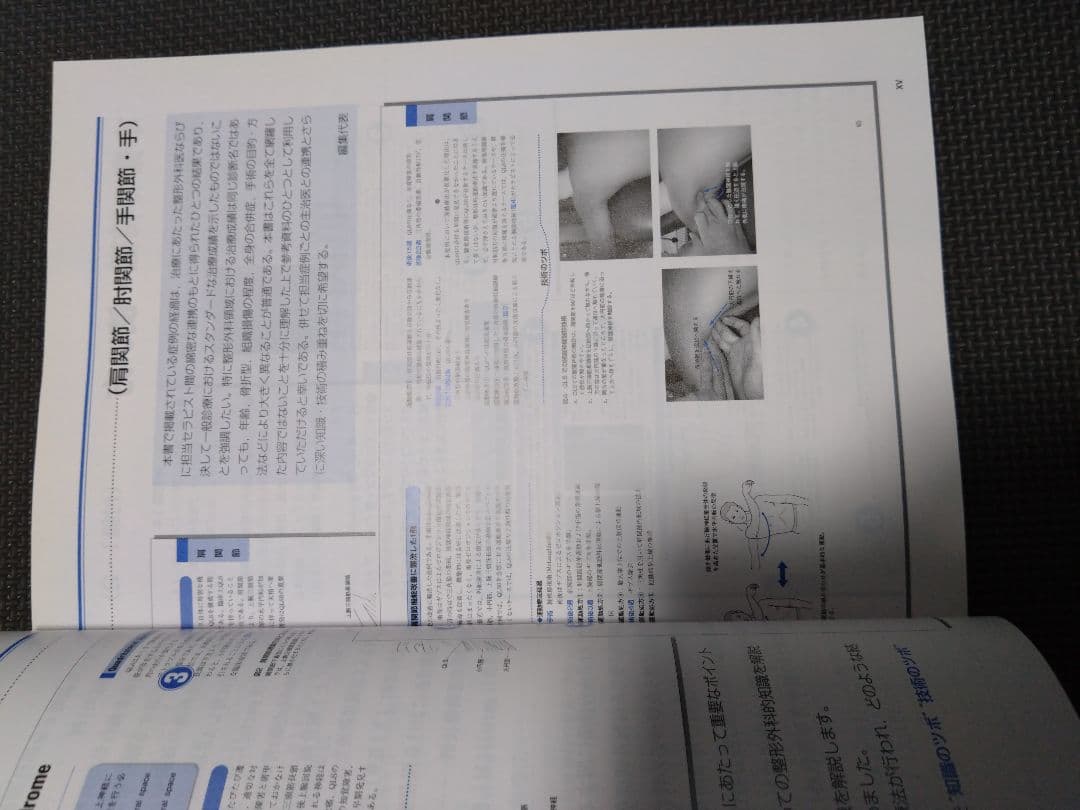 触診技術　整形外科ナビゲーション　上肢2冊セット　理学療法　新人　作業療法　PT