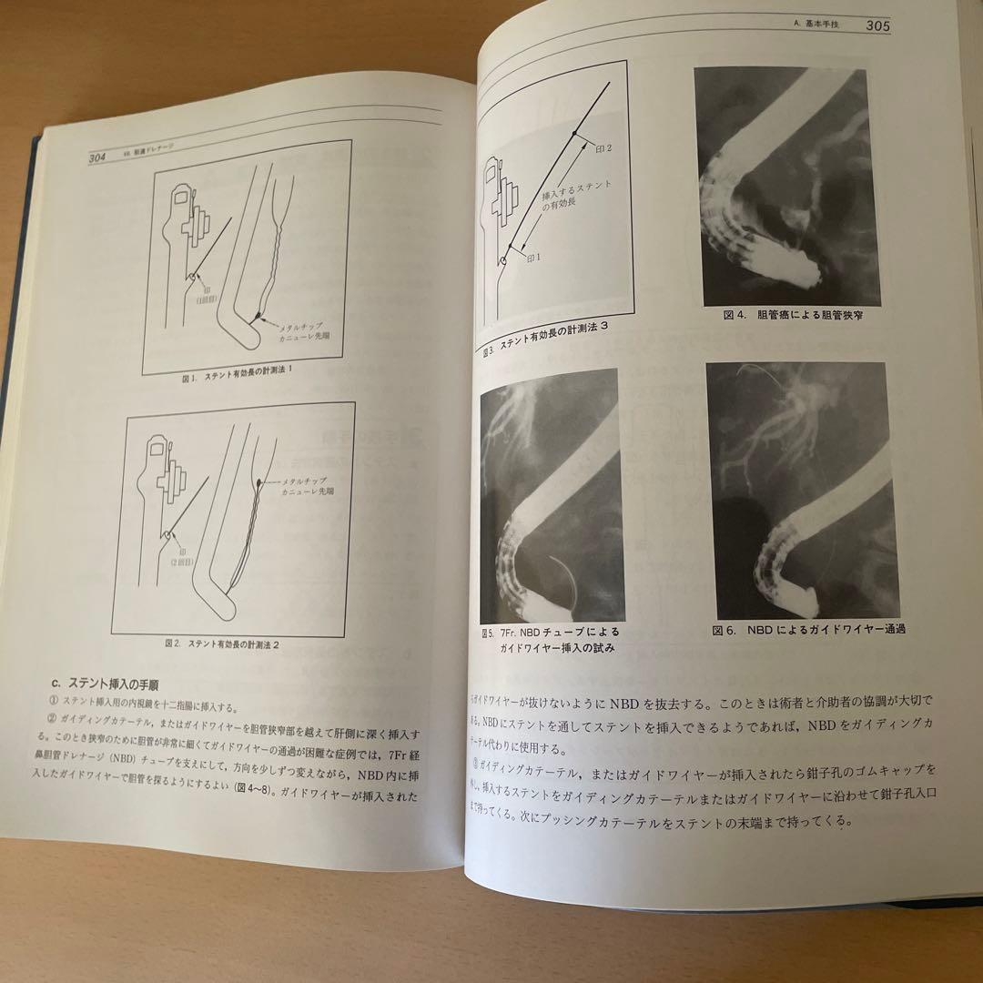 消化器治療内視鏡の基本手技