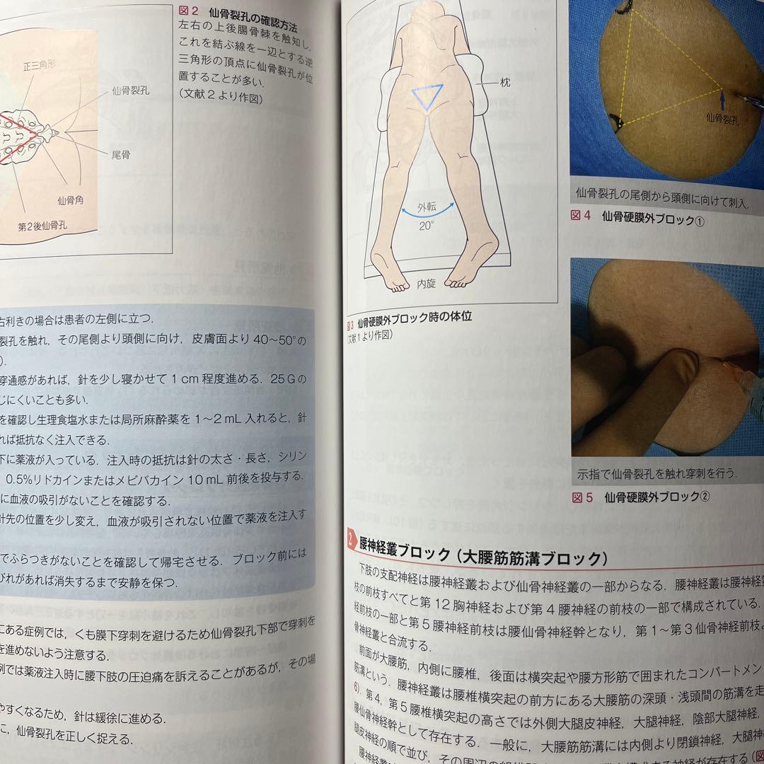 シンプルに打てる!外来での神経ブロック